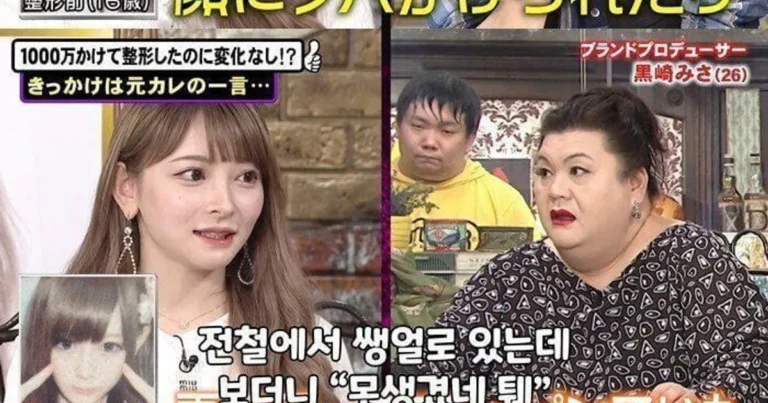 성형수술에 1500만엔 쓴 일본 여자