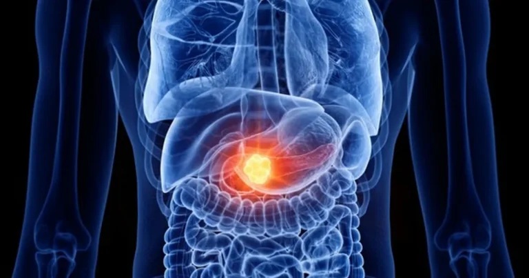 나도 모르게 “입이 이 상태라면” 췌장암 초기 신호입니다, 제발 조심하세요.