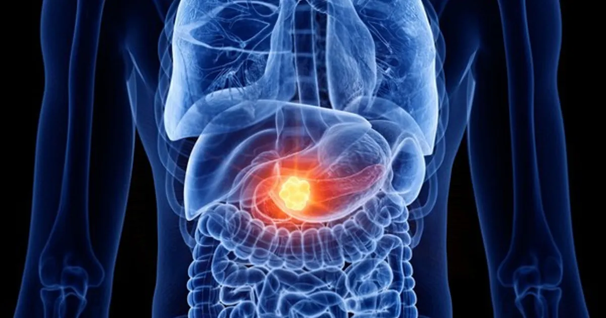 348dbba3202fbc9c9382ea022beb489f85a0c55ca272d95ce78d2434c60af1d9