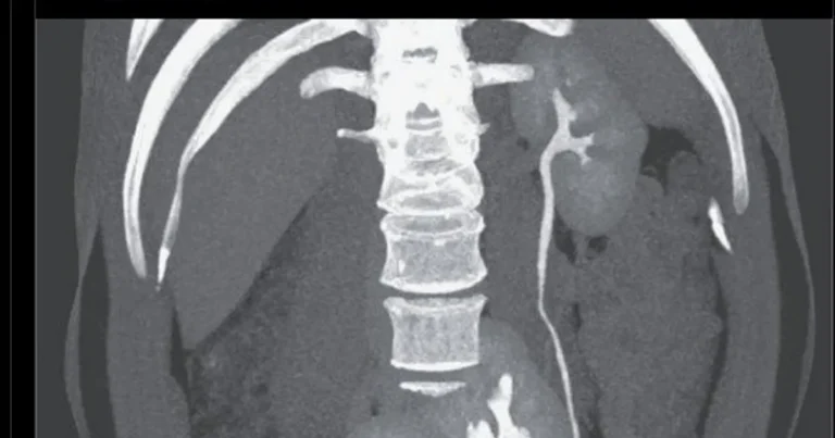의사: “당신은 생물학적 복권에 당첨됐군요.” 환자: “무슨 말씀이세요?”