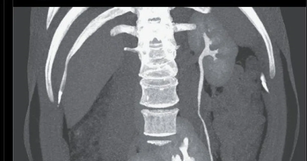 67d46853a38acd4a0555775954c919c178002cc82c9f0de040ac6a13eb2760d4