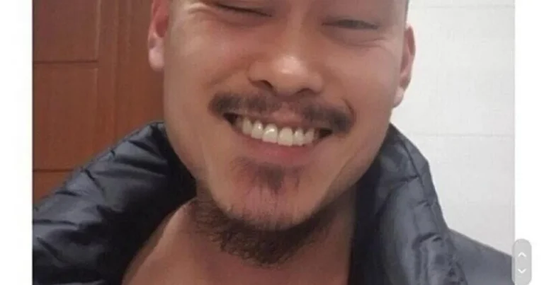 어느 디시인 탈모 인증 레전드,,