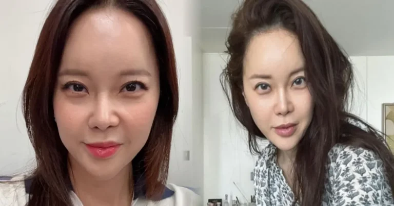 백지영, 성형 비용만 10억? 뒤늦은 ‘눈·코’ 성형 수술 후회 “한 번에 몰아서 하지 마라”