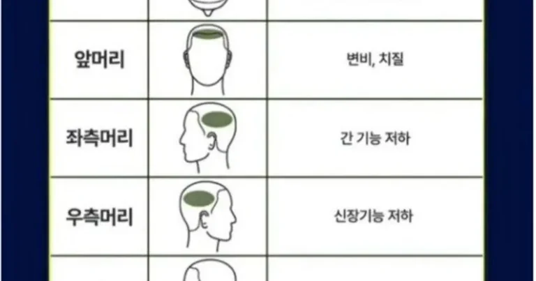 흰머리 나는 부위로 알수 있는 건강상태.jpg