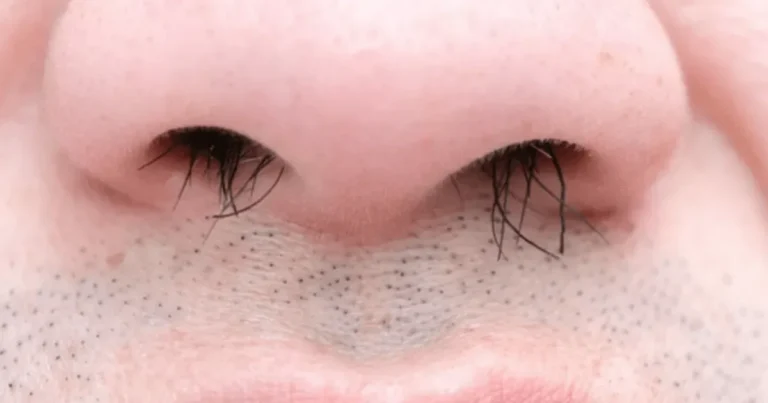 삐져나온 코털 절대 ‘이렇게 뽑으면’ 안 됩니다. 세균이 바로 뇌까지 올라갑니다