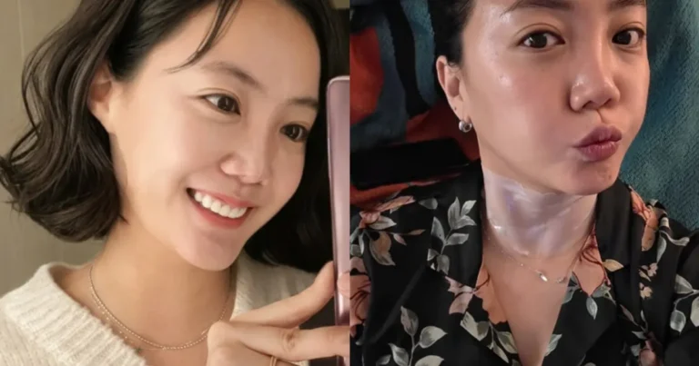 코 재수술로 중형차 한 대 값 쓴 37세 여배우, 목주름까지 케어하는 ‘관리의 여왕’