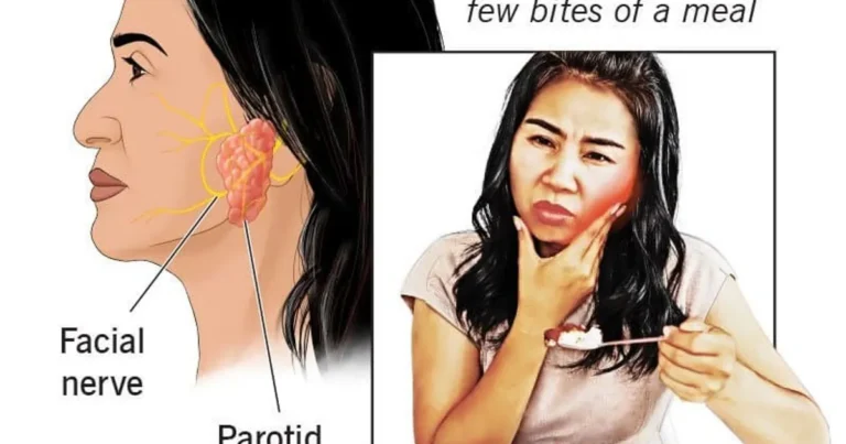 의외로 증상자 여럿있다는 희귀질환