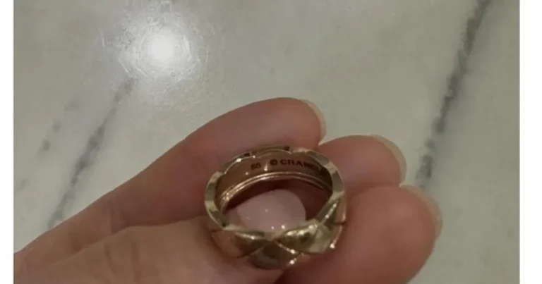 샤넬 반지끼고 습진 생긴 사람들