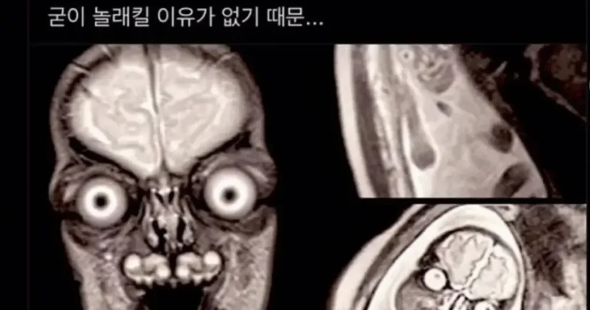 F112f110af2ac01e17cdf8b430e389ccd70fca1bec60b05b10fd9f6e018734de