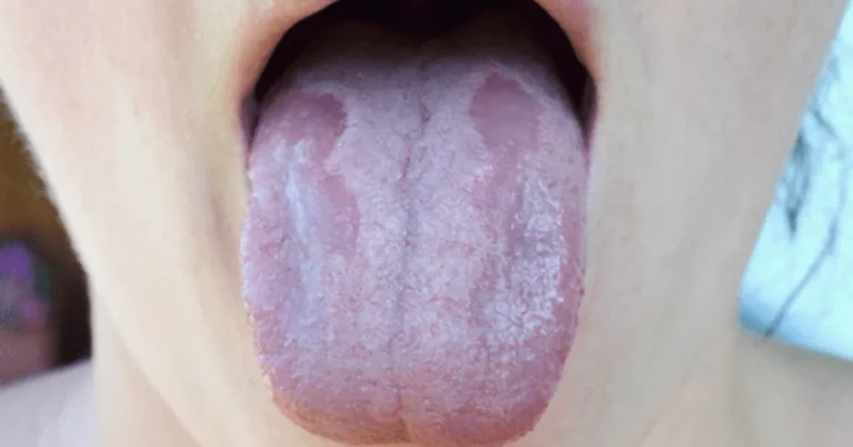양치질 “이렇게 하면 무조건 입 냄새납니다” 치과 의사가 꼭 닦는 ‘이 부위’