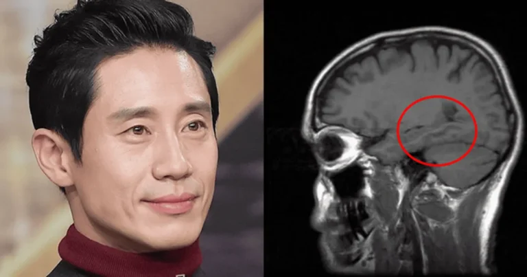 “내가 뭘 하려고 했지?”…배우 신하균, ‘뇌 해마 손상’ 위태로운 상태…”술, 커피 모두 끊었다”