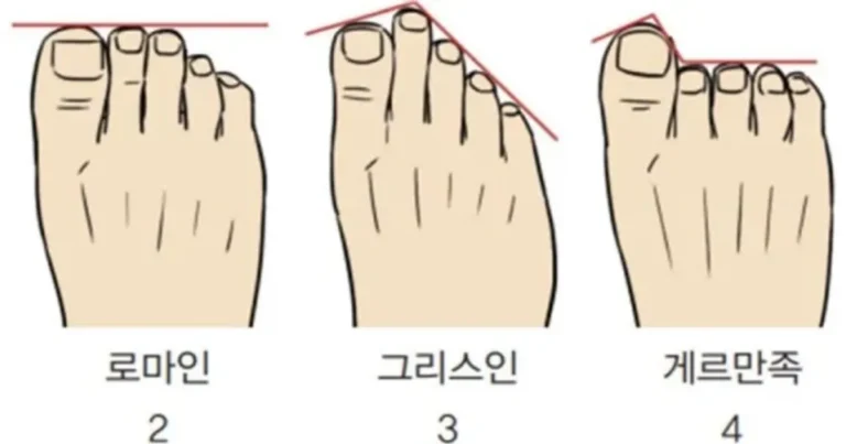 당신의 발은 어느 인종에 가깝습니까